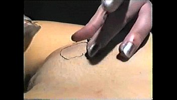 Long needle treatment
